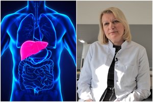 Pavojingas virusas puola žmogaus kepenis: profesorė įspėjo – užkratas plinta per maistą