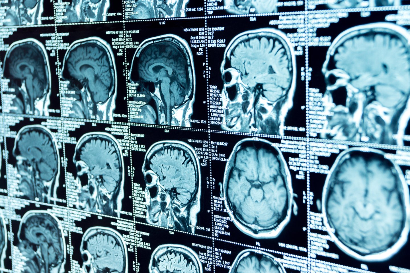 Smegenys.<br>123rf.com nuotr.