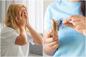 Moteriai ant veido atsivėrė žaizdos ir slinko plaukai – paaiškėjo, kad tragiškai trūksta svarbios medžiagos