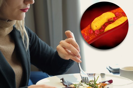 Prieštarauja tam, ką ilgai kartojo ekspertai: valgydami tai kasdien – mažinate „blogąjį“ cholesterolį