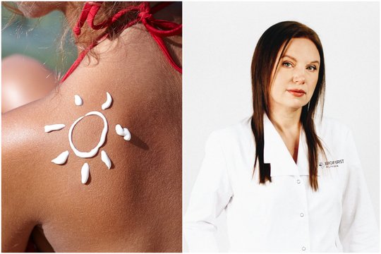 Nudegėte saulėje? Papasakojo, kaip gelbėti odą, ir atskleidė, kodėl liaudiškas priemones reikėtų pamiršti