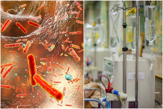 Per trumpą laiką Europoje išplito mirtina bakterija: įprasti vaistai prieš ją neveikia