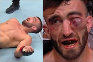 Neįtikėtina – krito UFC nokdaunų rekordas: sumaitoto kovotojo veidas pasako viską