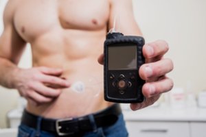 VLK: sveikatos draudimą turintys pacientai gyvybiškai svarbia įranga gali naudotis namuose