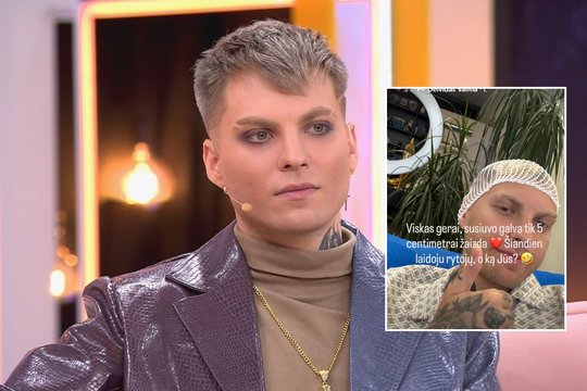 Važiuodamas autobusu atlikėjas Deividas Valma susižalojo ir prarado sąmonę: galvoje – 5 cm žaizda