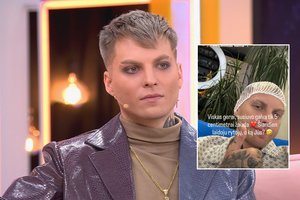 Važiuodamas autobusu atlikėjas Deividas Valma susižalojo ir prarado sąmonę: galvoje – 5 cm žaizda