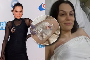 Po kovos su vėžiu – dar vienas smūgis atlikėjai Jessie J: atsidūrė ligoninėje