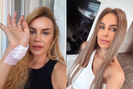 Skyrybas ir ligas išgyvenusiai K. Meseguer – dar vienas išbandymas: įkando beždžionė