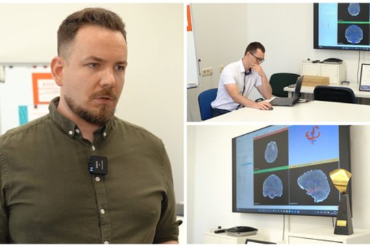 Sukūrė technologiją, kuri padės išgelbėti ne vieną gyvybę: jau testuoja gydymo įstaigose