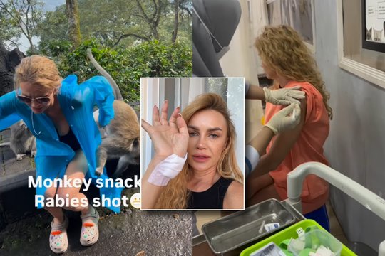 Paviešintas vaizdo įrašas, kaip Kristinai Meseguer įkando beždžionė