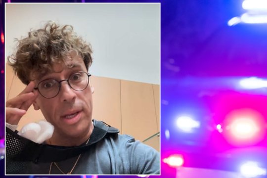 Avarija Jūrmaloje: aiškėja, kaip buvo sužeistas Maksimas Galkinas