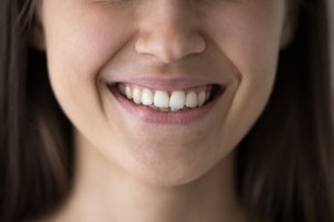 3 dantų balinimo namuose mitai: ne tik pažeidžia emalį, bet ir didina apsinuodijimo riziką