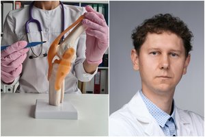 Gydytojas ortopedas sugriovė mitą apie sąnarių keitimą: tai ne tik senjorams