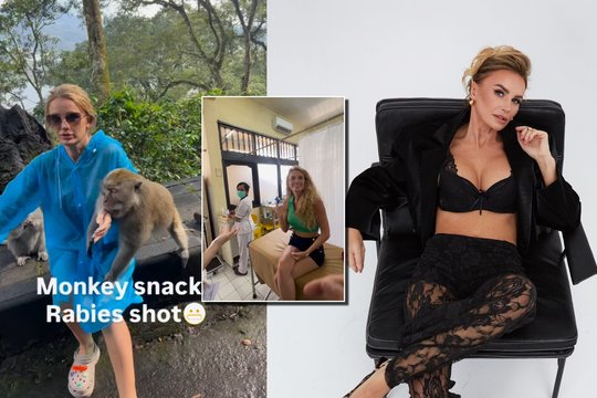 Po skaudaus beždžionės įkandimo – naujos žinios iš K. Meseguer: slaugytoja atskleidė galimą gyvūnėlio likimą