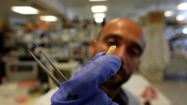 Proveržis odontologijoje: mokslininkai sukūrė naują dantų gydymo metodą