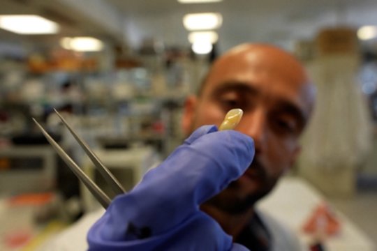 Proveržis odontologijoje: mokslininkai sukūrė naują dantų gydymo metodą