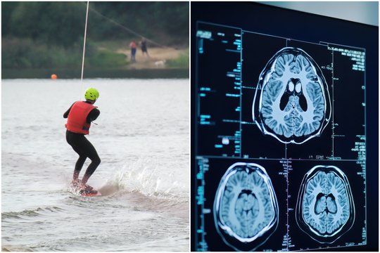 Ežere užsikrėtė ypač mirtina liga: vyro organizme – smegenis „ėdanti“ ameba