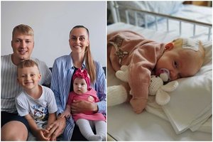 Kauno klinikų medikai atliko unikalią operaciją vos 4 mėnesių mergytei