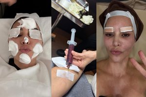 Kim Kardashian gerbėjus šokiravo keistos procedūros Pietų Korėjoje: injekcijos, lipni juosta ant antakių ir kaukės