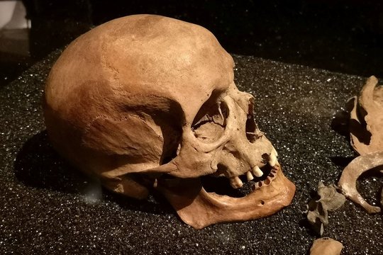 Šiurpusis verslas: pasaulyje auga prekyba žmonių palaikų dalimis