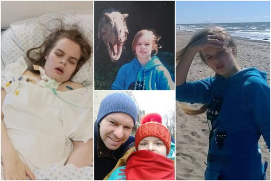 25-erių Ugnės gyvenimą griauna reta liga, dėl kurios susiraizgo kūnas: „Atrodau bejėgiškai“