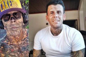 Labiausiai išsitatuiravęs Brazilijos žmogus ryžosi pribloškiantiems pokyčiams: skausmus kenčia dėl kilnaus tikslo