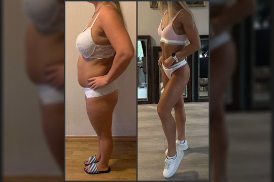 20 kg numetusi Agnė iš mitybos išbraukė vos tris dalykus: „Jaučiuosi lyg laimėjusi loterijoje“