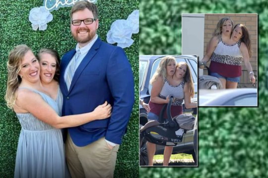 Po gandų apie galimą šeimos pagausėjimą – pirmi žinomų Siamo dvynių kadrai su naujagimiu