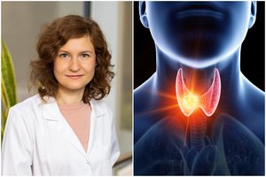 Gydytoja apie išskirtinį vėžio tipą, kuris negydomas chemoterapija – sergančių vis daugėja