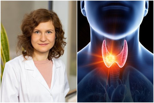Gydytoja apie išskirtinį vėžio tipą, kuris negydomas chemoterapija – sergančių vis daugėja
