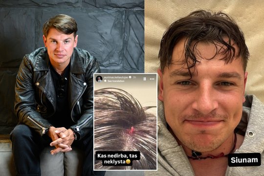 Aurimas Valujavičius patyrė rimtą galvos traumą: teko siūti