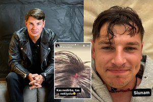 Aurimas Valujavičius patyrė rimtą galvos traumą: teko siūti