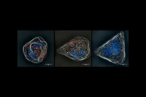 Audinių inžinerija: Mokslas kuriantis ateities mediciną