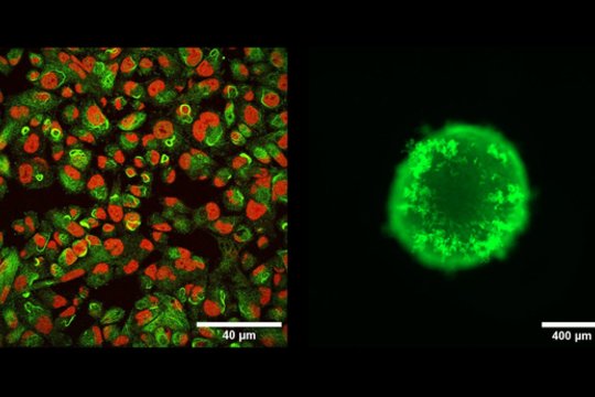 Kodėl laboratorijose modeliuojamas vėžys?