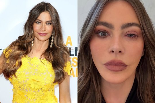 Paaiškėjo, kodėl Sofia Vergara nepasirodė „Emmy“ apdovanojimuose: prireikė medikų pagalbos