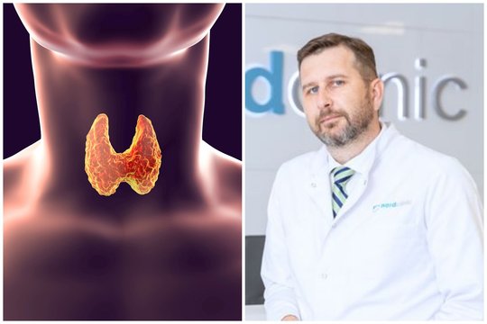 Skydliaukės ligos: gydytojas išsklaidė labiausiai paplitusius mitus