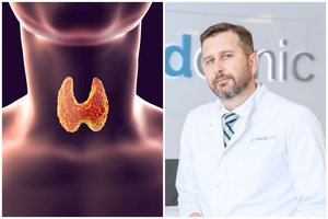 Skydliaukės ligos: gydytojas išsklaidė labiausiai paplitusius mitus