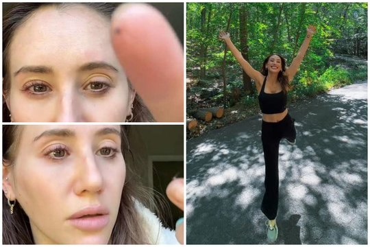 Nubudusi ryte moteris akyje pajuto kažką keista – radinys sukėlė šoką