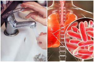 Lietuvoje fiksuota mirtis nuo legioneliozės: daugelis pamiršta tris elementarias taisykles