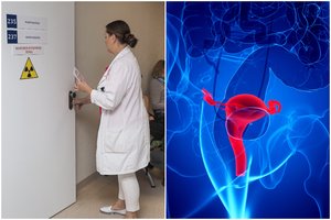 Lietuvoje dažnas vėžys – mažai kam girdėtas: sergančių moterų vis daugėja