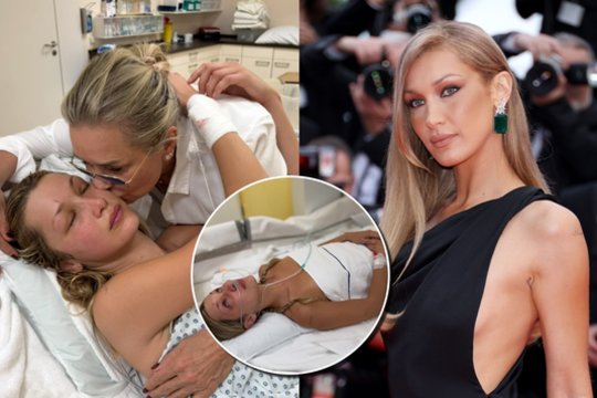 Supermodelis Bella Hadid kovoja su gyvybei pavojinga liga: vaizdai iš ligoninės sukrečia