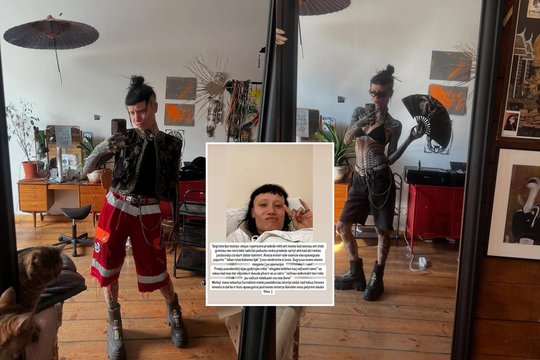 Vilniaus gimdymo namuose operacijos laukusi žinoma dizainerė susidūrė su diskriminacija: gydytojui neįtiko tatuiruotas kūnas
