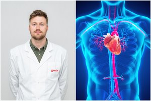 Itin mirtina liga – tiksinti bomba: kraujagyslių chirurgas pasakė, kaip jos nepražiopsoti