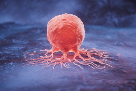 Pasaulinio tyrimo duomenimis, keturių iš 10 mirčių nuo vėžio būtų galima išvengti