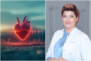 Gydytoja siūlo imti pavyzdį iš japonų: tai neleidžia formuotis trombams