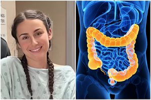 Jauna mokytoja negali patikėti, kad susirgo vėžiu: buvo tik vienas simptomas