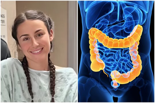 Jauna mokytoja negali patikėti, kad susirgo vėžiu: buvo tik vienas simptomas