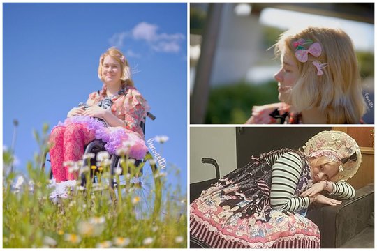 Neįgaliojo vežimėliu riedanti jauna vilnietė stulbina savo išvaizda: tenka atlaikyti ir priekabiavimus