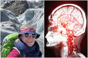 Monikos galvoje – netikėtas gydytojų atradimas: „Išsigandau iš tikrųjų“