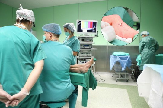 Ant Klaipėdos chirurgų stalo pabudusi moteris apsipylė ašaromis: akimirksniu suprato – medikai padarė kraupią klaidą